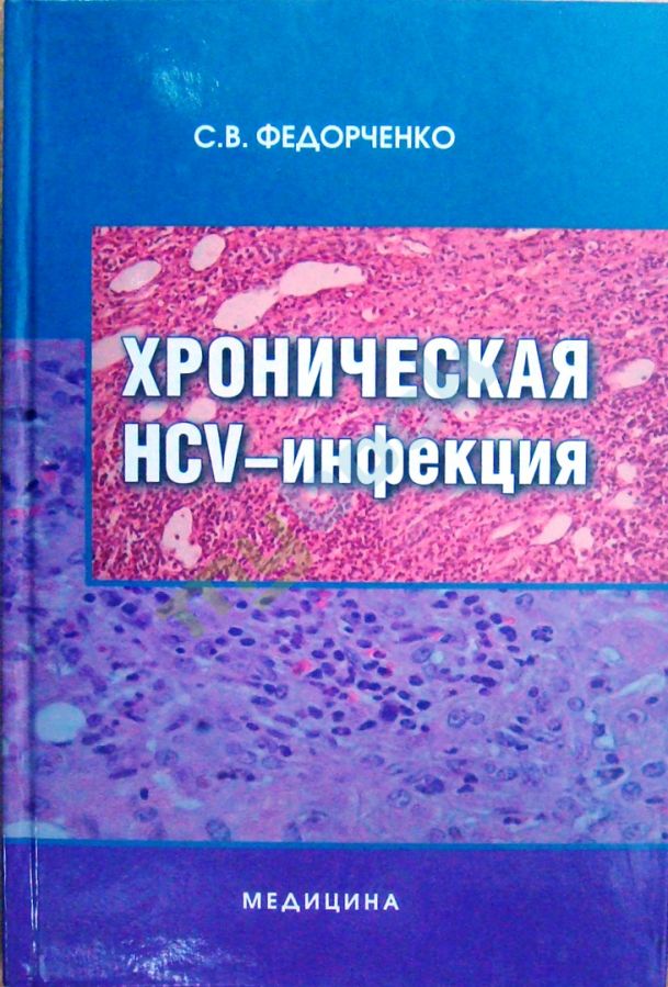 купить книгу Хроническая HCV-инфекция