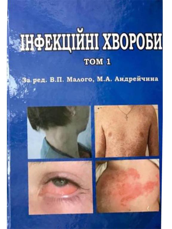 купить книгу Інфекційні хвороби Том 1