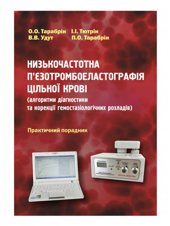 придбати книгу Низькочастотна п`єзотромбоеластографія цільної крові (алгоритми діагностики та корекції гемостазіологічних розладів)