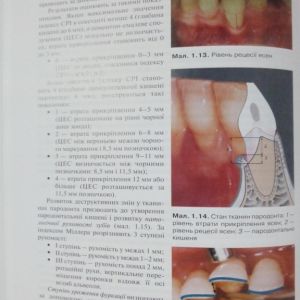 Терапевтична стоматологія дитячого віку. Том 2