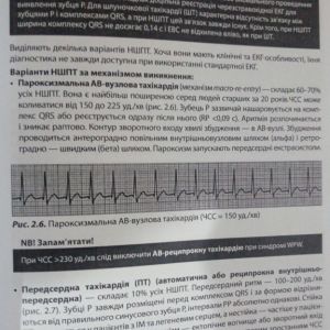 Електрокардіологічна діагностика і лікування в невідкладній кардіології